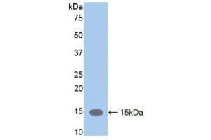 Western blot analysis of recombinant Mouse LIFR. (LIFR 抗体  (AA 381-485))