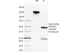 SDS-PAGE Analysis Purified CD28 Mouse Monoclonal Antibody (C28/1636). (CD28 抗体)