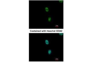 ICC/IF Image Immunofluorescence analysis of methanol-fixed HeLa, using SAP130, antibody at 1:500 dilution. (SF3B3 抗体  (C-Term))