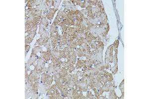 Immunohistochemistry of paraffin-embedded rat heart using FLII antibody (ABIN7267217) at dilution of 1:100 (40x lens). (FLII 抗体  (AA 400-660))