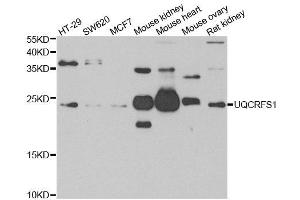 Western blot analysis of extracts of various cell lines, using UQCRFS1 antibody. (UQCRFS1 抗体)