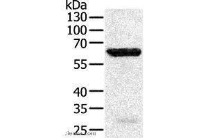 Western blot analysis of Jurkat cell, using TRAF5 Polyclonal Antibody at dilution of 1:450