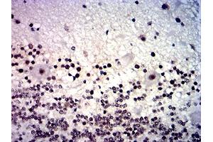 Immunohistochemical analysis of paraffin-embedded cerebellum tissues using MYCN mouse mAb with DAB staining. (MYCN 抗体  (AA 337-464))