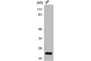 Western Blot analysis of 293 cells using Trypsin-1 Polyclonal Antibody (PRSS1 抗体  (Internal Region))