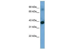 Western Blot showing SFXN4 antibody used at a concentration of 1-2 ug/ml to detect its target protein. (Sideroflexin 4 抗体  (N-Term))