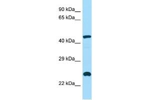 WB Suggested Anti-INPP5A Antibody Titration: 1. (INPP5A 抗体  (C-Term))