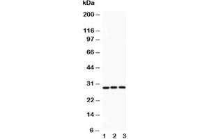 Western blot testing of ATF1 antibody and Lane 1:  rat spleen;  2: HeLa;  3: COLO320 (AFT1 抗体  (AA 1-271))