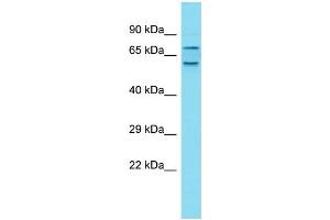 Host: Rabbit Target Name: CXorf30 Sample Type: Fetal Liver lysates Antibody Dilution: 1. (CXorf22 抗体  (C-Term))