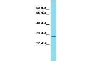Host: Rabbit Target Name: C17orf77 Sample Type: RPMI-8226 Whole Cell lysates Antibody Dilution: 1. (C17ORF77 抗体  (C-Term))