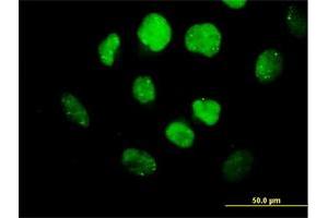 Immunofluorescence (IF) image for anti-Oligodendrocyte Transcription Factor 3 (OLIG3) (AA 1-272) antibody (ABIN531183)