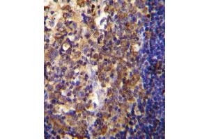 His6-DEP-1 Antibody (ABIN655037 and ABIN2844669) immunohistochemistry analysis in formalin fixed and paraffin embedded human tonsil tissue followed by peroxidase conjugation of the secondary antibody and DAB staining. (PTPRJ 抗体  (His6))