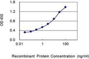 Detection limit for recombinant GST tagged RAB15 is 0. (RAB15 抗体  (AA 99-208))