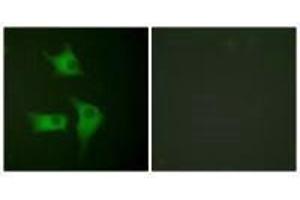 Immunofluorescence analysis of HeLa cells, using p15 INK antibody. (CDKN2B 抗体)