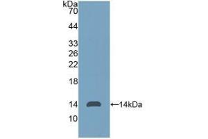 Detection of Recombinant Thy1, Human using Polyclonal Antibody to Cluster of Differentiation 90 (CD90) (CD90 抗体  (AA 20-133))