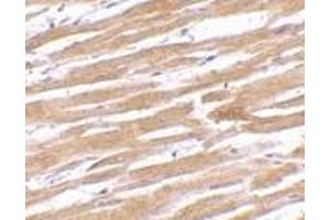 Immunohistochemistry of GPVI in human heart tissue with GPVI antibody at 10 μg/ml. (GP6 抗体  (C-Term))