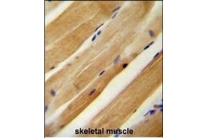MLXIP antibody (N-term) (ABIN654186 and ABIN2844037) immunohistochemistry analysis in formalin fixed and paraffin embedded human skeletal muscle followed by peroxidase conjugation of the secondary antibody and DAB staining.
