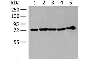 Western blot analysis of 293T cell and Mouse heart tissue lysates using CALCOCO1 Polyclonal Antibody at dilution of 1:300 (CALCOCO1 抗体)