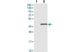 Western blot analysis of Lane 1: Negative control (vector only transfected HEK293T lysate), Lane 2: Over-expression Lysate (Co-expressed with a C-terminal myc-DDK tag (~3. (ERGIC1 抗体)