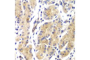 Immunohistochemistry of paraffin-embedded human gastric using HRAS antibody (ABIN5975854) at dilution of 1/100 (40x lens). (HRAS 抗体)