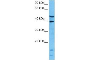 Host:  Mouse  Target Name:  L Sample Tissue:  Mouse Pancreas  Antibody Dilution:  1ug/ml (LARP6 抗体  (Middle Region))
