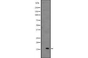 Western blot analysis of IL15 expression in Foetal liver lysate,The lane on the left is treated with the antigen-specific peptide. (IL-15 抗体  (Internal Region))