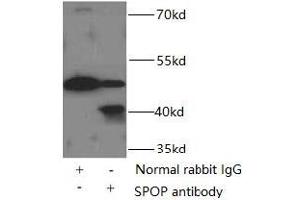 IP analysis of HeLa cell lysates (3000 μg), using SPOP antibody (1/500 dilution, 3 μg). (SPOP-B 抗体)