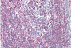 Human Tonsil (formalin-fixed, paraffin-embedded) stained with BACH2 antibody ABIN462219 followed by biotinylated goat anti-rabbit IgG secondary antibody ABIN481713, alkaline phosphatase-streptavidin and chromogen.