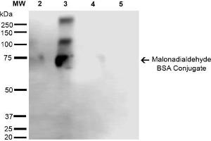 Western Blot analysis of Malondialdehyde-BSA Conjugate showing detection of 67 kDa Malondialdehyde -BSA using Mouse Anti-Malondialdehyde Monoclonal Antibody, Clone 6H6 . (Malondialdehyde 抗体  (Biotin))