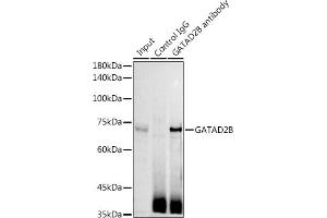Immunoprecipitation analysis of 300 μg extracts of Jurkat cells using 3 μg GB antibody (ABIN6127943, ABIN6140978, ABIN6140979 and ABIN6225075). (GATAD2B 抗体  (AA 1-120))