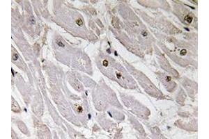 Immunohistochemistry analyzes of Pax-1 antibody in paraffin-embedded human heart tissue. (PAX1 抗体)