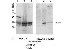 Western Blot (WB) analysis of specific cells using Antibody diluted at 1:1000. (PPP2CA 抗体  (Thr278))