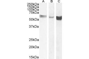 Western Blotting (WB) image for anti-Monoamine Oxidase B (MAOB) (Internal Region) antibody (ABIN185506)