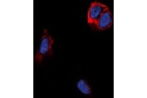 Immunofluorescent analysis of TRB1 staining in MCF7 cells. (TAS2R14 抗体)
