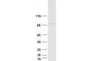 Validation with Western Blot
