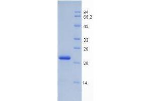 SDS-PAGE analysis of Rat Insulin Like Growth Factor Binding Protein 3 (IGFBP3) Protein. (IGFBP3 蛋白)