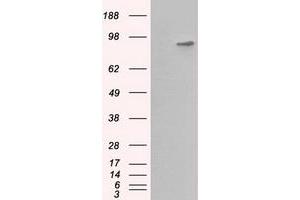 HEK293T cells were transfected with the pCMV6-ENTRY control (Left lane) or pCMV6-ENTRY BHMT (Right lane) cDNA for 48 hrs and lysed. (BHMT 抗体)