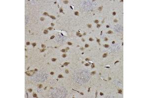 Immunohistochemistry of paraffin-embedded rat brain using MonoMethyl-Histone H3-K9 antibody (ABIN7267685) at dilution of 1:100 (40x lens).