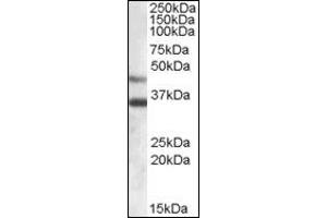 Image no. 2 for anti-Arylsulfatase B (ARSB) (Internal Region) antibody (ABIN372553) (Arylsulfatase B 抗体  (Internal Region))