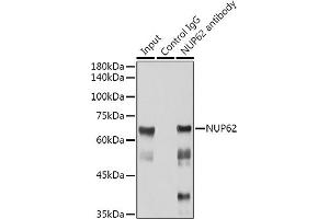 Immunoprecipitation analysis of 300 μg extracts of Jurkat cells using 3 μg NUP62 antibody (ABIN7269045). (NUP62 抗体)