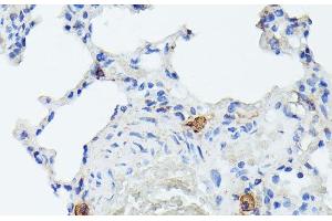 Immunohistochemistry of paraffin-embedded Rat lung using TIAL1 Polyclonal Antibody at dilution of 1:100 (40x lens). (TIAL1 抗体)