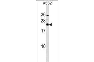 HAND2 Antibody (Center) (ABIN1538642 and ABIN2848660) western blot analysis in K562 cell line lysates (35 μg/lane). (HAND2 抗体  (AA 81-110))