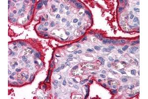 Immunohistochemical analysis of paraffin-embedded human Placenta tissues using ITGA5 mouse mAb (ITGA5 抗体)