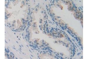 Immunohistochemistry (IHC) image for anti-Secretagogin, EF-Hand Calcium Binding Protein (SCGN) (AA 1-276) antibody (ABIN7436363)