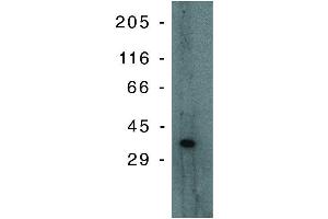 anti-PIG3 (p53 Inducible Gene 3) antibody