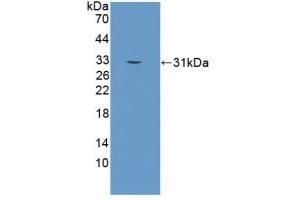 Detection of Recombinant KLK2, Human using Polyclonal Antibody to Kallikrein 2 (KLK2) (Kallikrein 2 抗体  (AA 19-261))