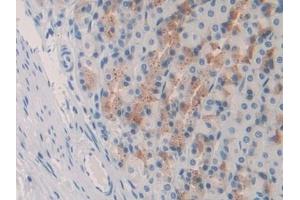 Detection of IL10 in Rat Stomach Tissue using Monoclonal Antibody to Interleukin 10 (IL10) (IL-10 抗体  (AA 19-178))