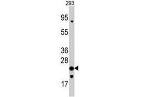 Western blot analysis of FXN polyclonal antibody  in 293 cell line lysates (35 ug/lane). (Frataxin 抗体  (C-Term))