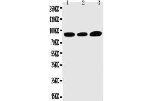 Anti-TRPV3 antibody, Western blotting Lane 1: HELA Cell Lysate Lane 2: A549 Cell Lysate Lane 3: MCF-7 Cell Lysate (TRPV3 抗体  (C-Term))