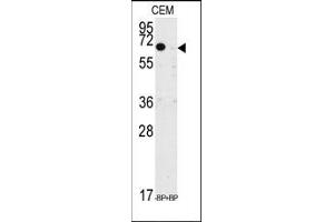 Image no. 2 for anti-Kruppel-Like Factor 10 (KLF10) (AA 19-49), (N-Term) antibody (ABIN360044) (KLF10/TIEG1 抗体  (N-Term))