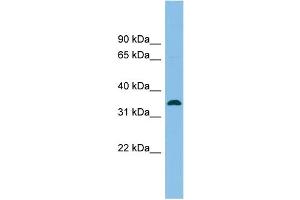 WB Suggested Anti-SRR Antibody Titration: 0. (SRR 抗体  (Middle Region))